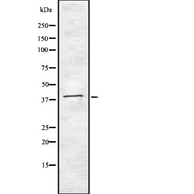 Polyclonal Rabbit anti-Human MNX1 / HB9 Antibody (WB)