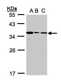 IHC-plus™ BPGM Antibody (aa1-246)