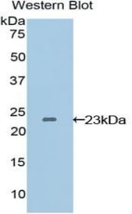 VEGFB Antibody (aa22-207)