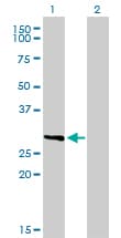FcERI / Fc Epsilon RI Antibody (clone 2C12-3B6)