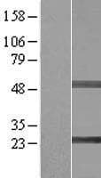 SIKE1 Protein (Over-Expression Lysate Myc-DDK (Flag))
