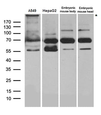 DICER1 / Dicer Antibody