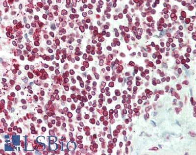 Polyclonal Rabbit anti-Human TMPO / TP / Thymopoietin Antibody (aa1-243, IHC, WB)