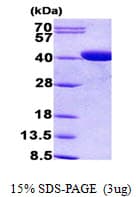 Human CPOX Protein (Recombinant His)