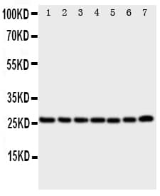 Polyclonal Rabbit anti-Human CACYBP Antibody (aa160-175, IHC, WB)