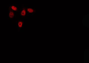 GIT2 Antibody