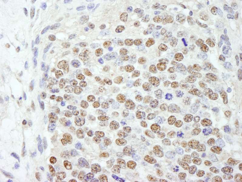 SF3B2 Antibody (aa775-825)