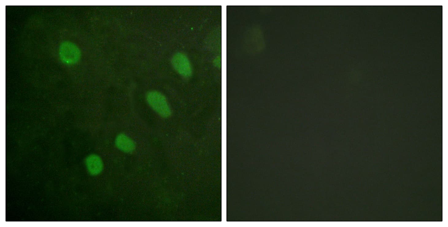 Polyclonal Rabbit anti-Human ATF2 Antibody (phospho-Ser480, IHC, IF, WB)