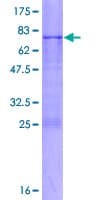 Human ADAMTSL4 Protein (Recombinant GST)