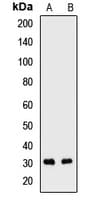 Polyclonal Rabbit anti-Human SNRPB2 Antibody (WB)