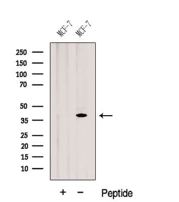 Polyclonal Rabbit anti-Human GALE / UDP-Glucose 4-Epimerase Antibody (WB)