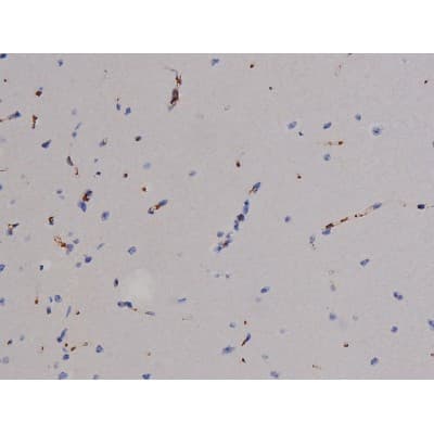 Polyclonal Rabbit anti-Human ZAP70 Antibody (phospho-Tyr319, IHC, IF, WB)
