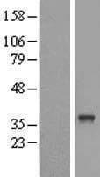 ABHD6 Protein (Over-Expression Lysate Myc-DDK (Flag))
