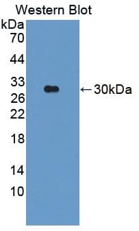 PARK2 / Parkin 2 Antibody (aa229-465, FITC)
