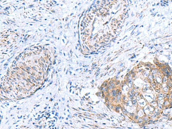 GCSH Antibody