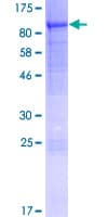 Human TMCO4 Protein (Recombinant GST)