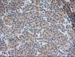 BAIAP2 / IRSP53 Antibody (clone OTI8G8)
