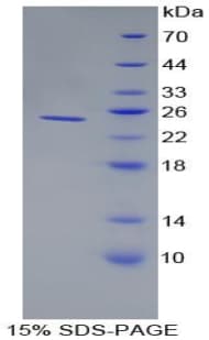 Rat ORM1 / Orosomucoid Protein (Recombinant His-T7)