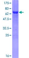 Human TDO2 Protein (Recombinant GST)