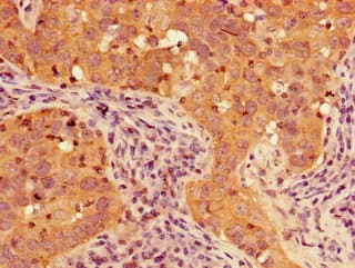 Polyclonal Rabbit anti-Human TIGAR Antibody (IHC, IF)