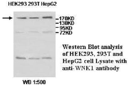 WNK1 Antibody (aa80-338)