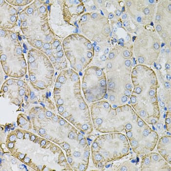 IHC-plus™ SLC4A4 / NBC1 Antibody