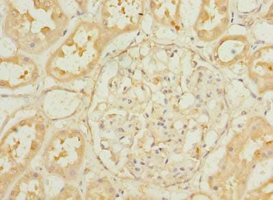Polyclonal Rabbit anti-Human PA2G4 / EBP1 Antibody (IHC, WB)