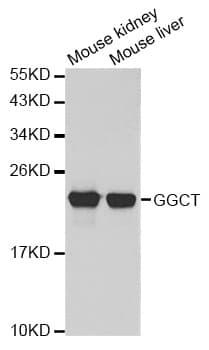 Polyclonal Rabbit anti-Human GGCT Antibody (IHC, WB)