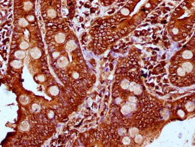Polyclonal Rabbit anti-Human PLS1 / Fimbrin Antibody (IHC, IF, WB)
