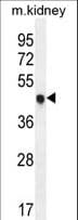 CDKN1C / p57 Kip2 Antibody (aa34-64)