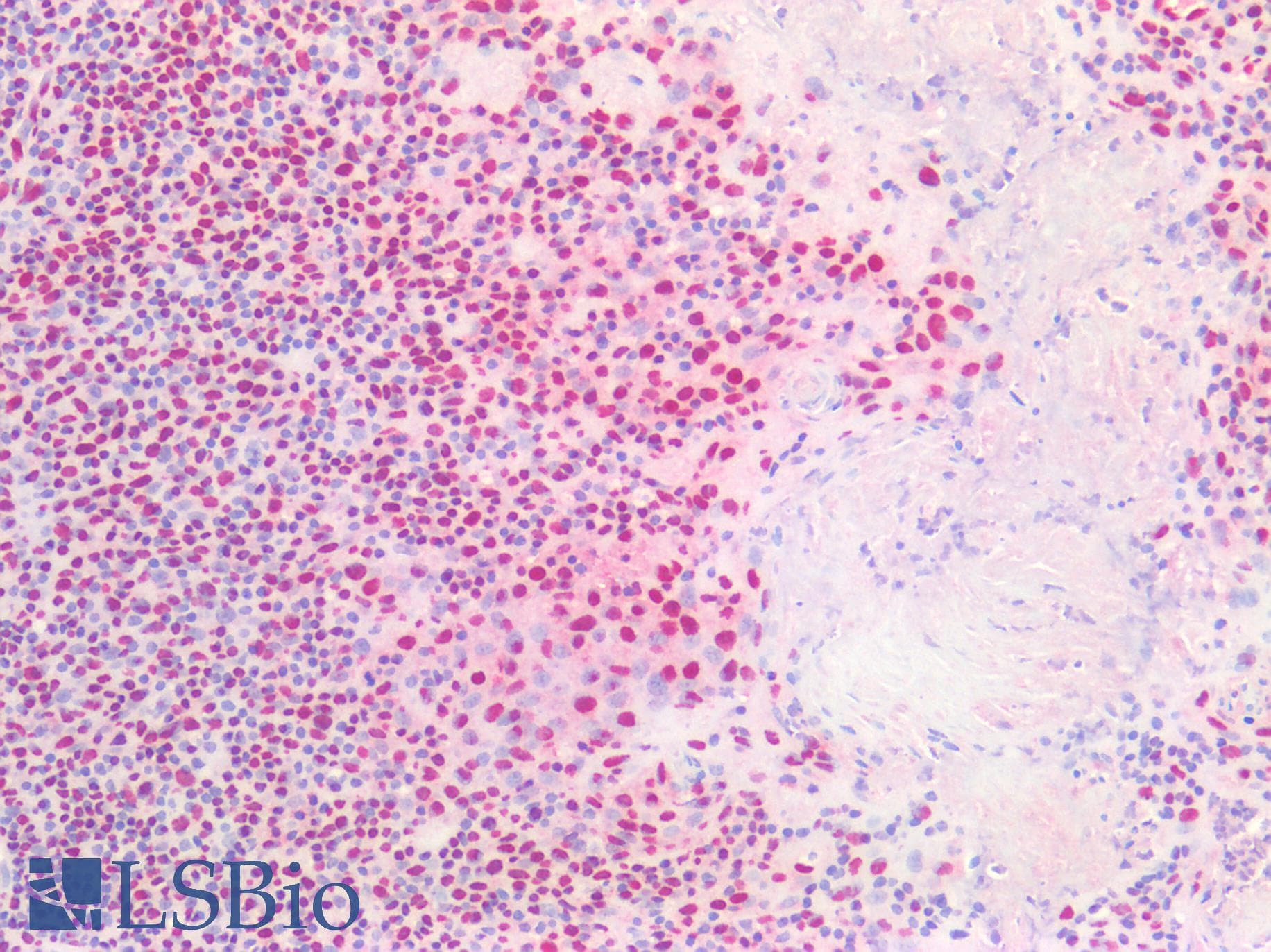 PathPlus™ Monoclonal Mouse anti-Human PLEKHG5 Antibody (clone 5A9, IHC, IF, WB)