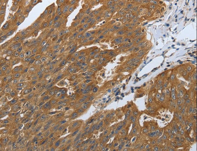 DLG4 / PSD95 Antibody
