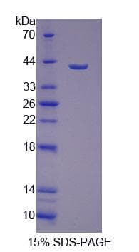 Human PDLIM1 Protein (Recombinant His-S)