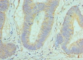 GOLM1 / GP73 / GOLPH2 Antibody (aa112-401)
