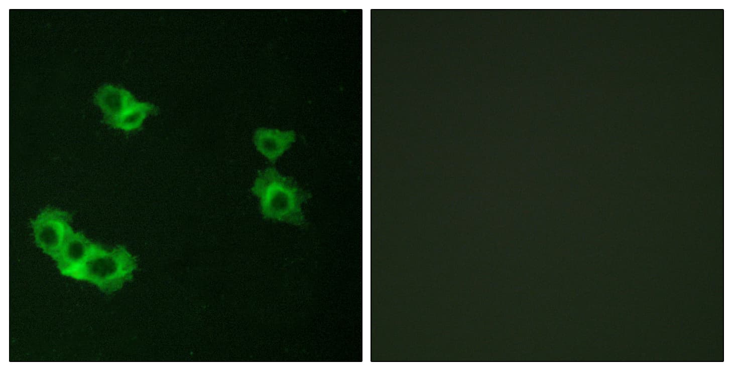 IHC-plus™ PTHR / PTHR1 Antibody (aa145-194)