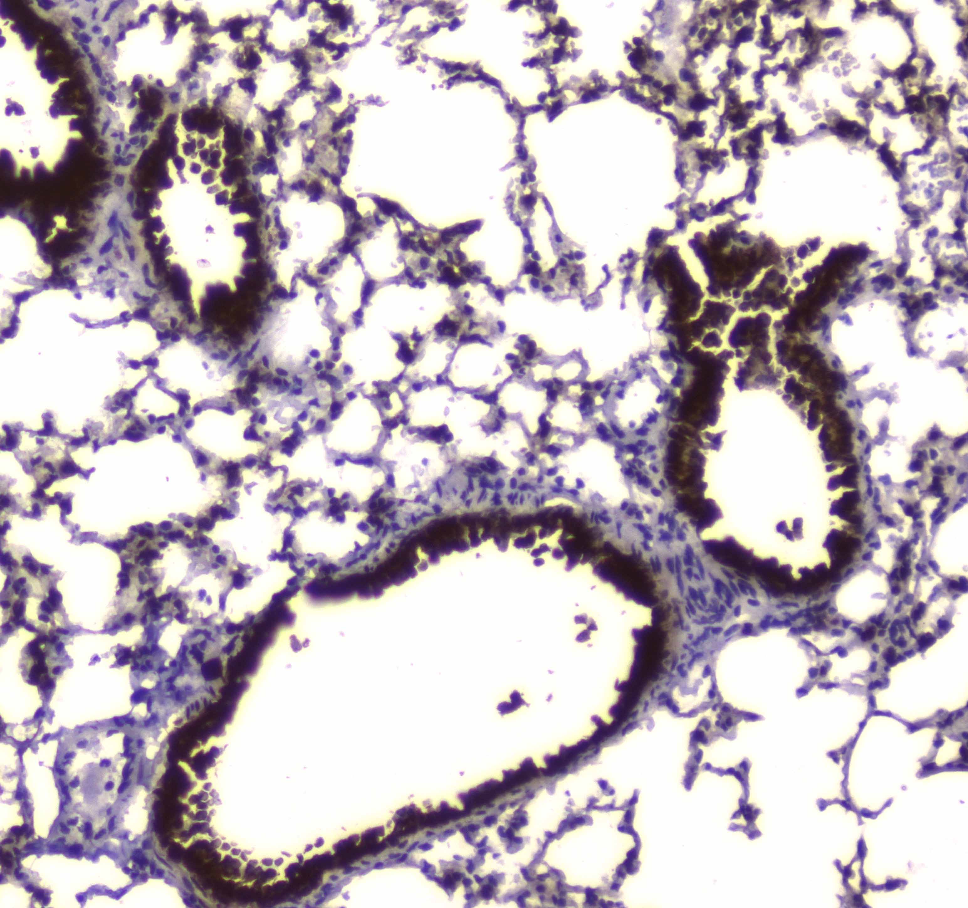 Carboxylesterase 1 / CES1 Antibody