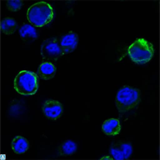 ROR1 Antibody