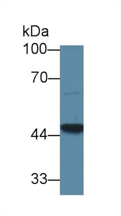 GCD / GCDH Antibody