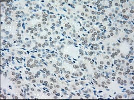 Monoclonal Mouse anti-Human MAP2K4 / MKK4 Antibody (clone OTI8A8, IHC, IF, WB)