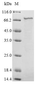 Human RSV F0 Protein (Recombinant 6His-B2M, N-terminus)