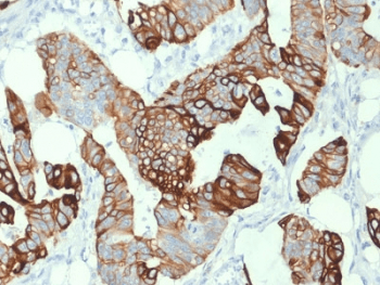 KRT20 / CK20 / Cytokeratin 20 Antibody (clone KRT20/1993, Ready-to-Use)