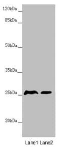RNF114 / ZNF313 Antibody