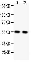 SLC2A4 / GLUT-4 Antibody (aa333-509)