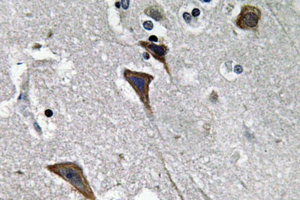 LEPR / Leptin Receptor Antibody (Leu662)