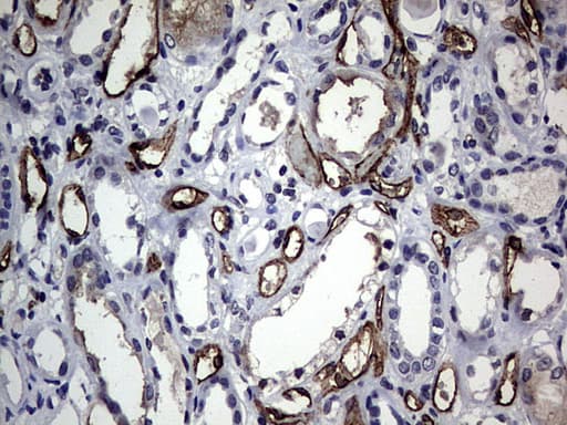 Monoclonal Mouse anti-Human CEACAM5 / CD66e Antibody (clone OTI5F2, aa35-680, IHC, WB)