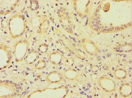 Polyclonal Rabbit anti-Human ARSF / Arylsulfatase F Antibody (aa1-200, IHC)
