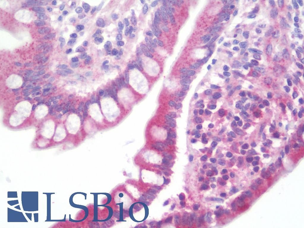 IHC-plus™ Polyclonal Rabbit anti-Human SLC22A4 / OCTN1 Antibody (aa514-542, IHC, WB)