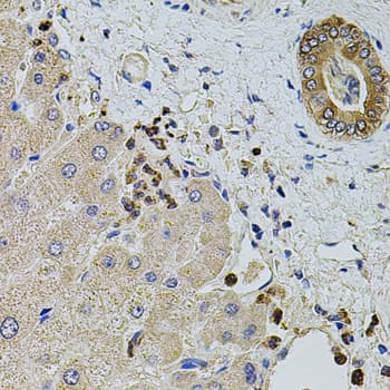Polyclonal Rabbit anti-Human KTN1 / Kinectin Antibody (IHC, WB)