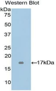 UMOD / Uromodulin Antibody (aa30-150)
