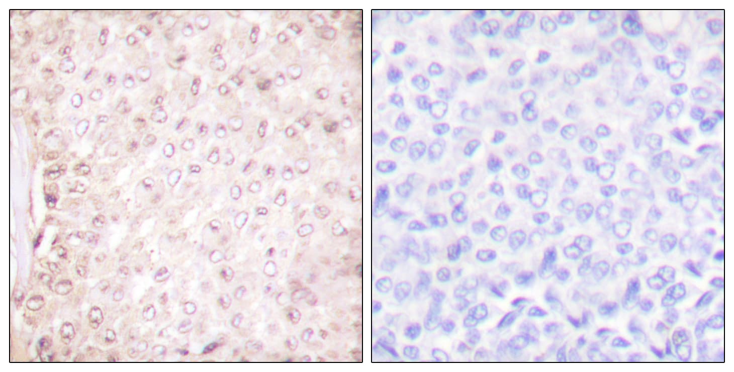 CSTB / Cystatin B / Stefin B Antibody (aa49-98)